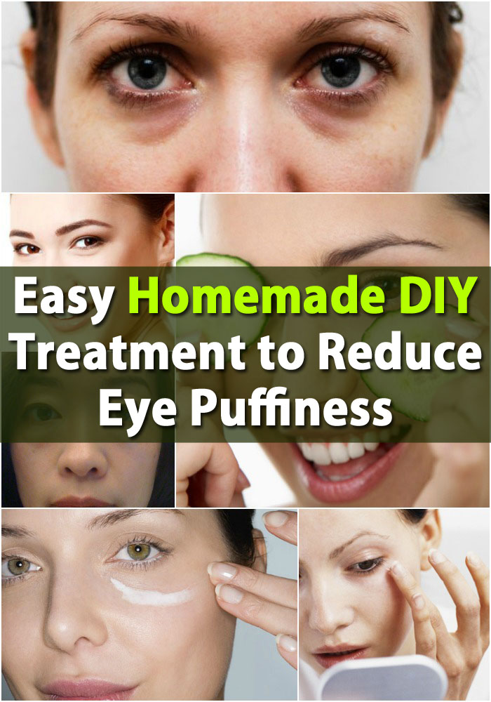 Natural Remedies For Puffy Eyes